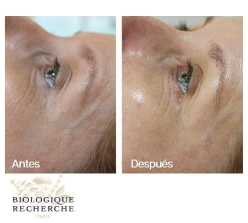 Biologique recherche tratamiento contorno de ojos colageno majadahonda