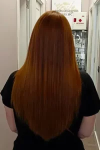 alisado tninoplastia